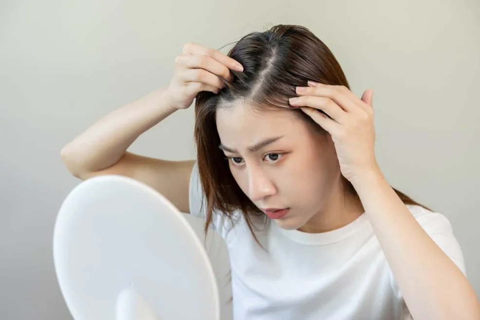 Najczęstsze problemy ze skórą głowy i włosami
